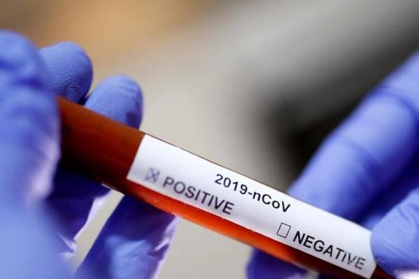 ثلاث اصابات بكورونا لسائقين في مركز العمري