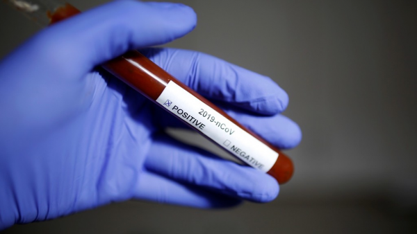 تسجيل 29 إصابة بفيروس كورونا في العراق