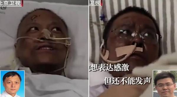 أعراض لم تكن معروفة.. فيروس كورونا يغير لون جلد ناجيين