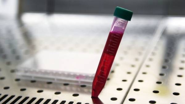 عالم مناعة روسي يقيّم فرص الوصول إلى لقاح ضد كورونا