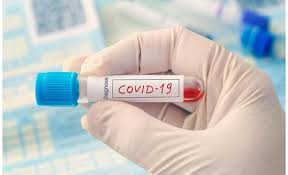 عجلون: 68 عينة نتائجها سلبية