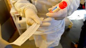 فيروس كورونا: لماذا يصعب توفير اختبارات الكشف عن الفيروس؟