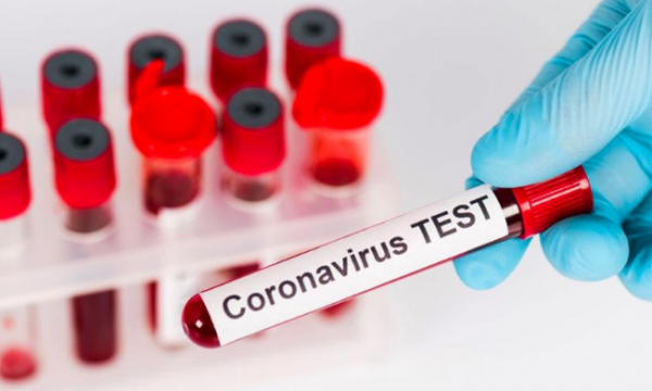 الغزو: 70 عينة سلبية وعدد الحالات في قسم العزل 11 حالة