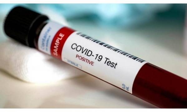 الأردن في المرتبة 112 بإصابات كورونا على مستوى العالم