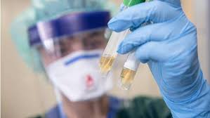 باستثناء زوجها .. نتائج فحص عينات مخالطي ممرضة الرمثا سلبية