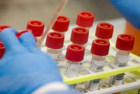 الاعلان عن (12) لقاح محتمل لكورونا ..(تفاصيل)