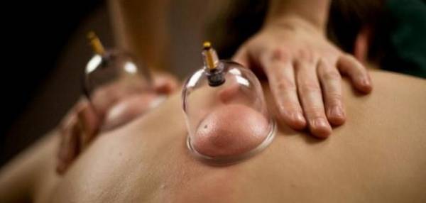 الحجامة: طريقتها وأبرز فوائدها