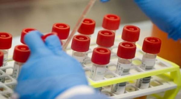 الصحة العالمية تعلن توقعاتها حول موعد الحصول على لقاح ناجح ضد فيروس كورونا