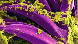 الصين تعلن عن حالة التأهب القصوى بعد الابلاغ عن حالة طاعون دبلي