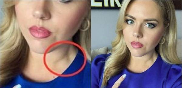 مذيعة تكتشف إصابتها بالسرطان بعد أن نبهها أحد المشاهدين