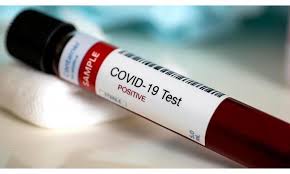 الحجر على 4 منازل في الرمثا و فحص 100 مخالط للمصاب