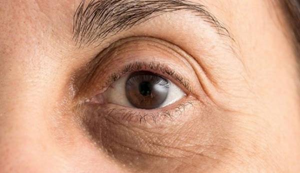 اليك طريقة بسيطة لإخفاء الهالات السوداء تحت العين