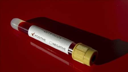 (4) وفيات و(417) إصابة جديدة بـفيروس كورونا في فلسطين