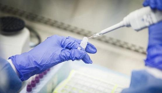 125 محطة ثابتة لفحص الفيروس قريبا