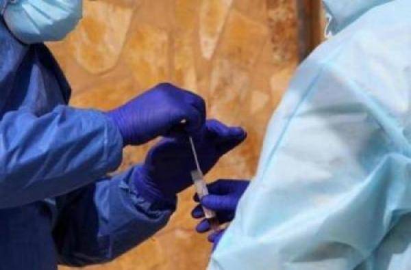 15.7 نسبة فحوصات كورونا الايجابية الأحد