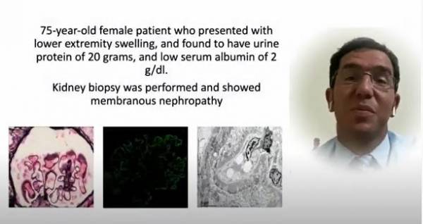 الدكتور ليث الربضي اول اردني يكتشف عامل مناعي جديد في مرض الزلال في امريكا  فيديو