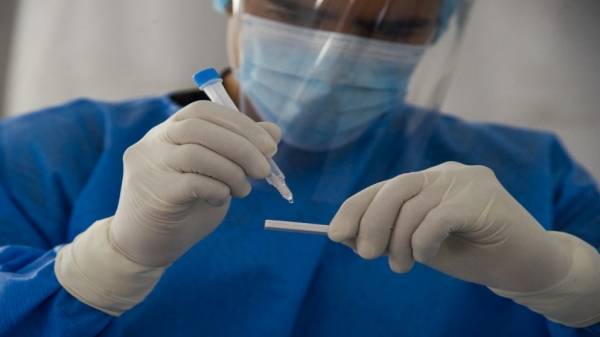 9.97 إيجابية فحوصات كورونا