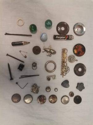 مستشفى الملكة رانيا العبدالله للأطفال ينجح بازالة أشياء غريبة يبتلعها الأطفال