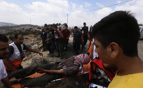 320 اصابة بمواجهات في نابلس