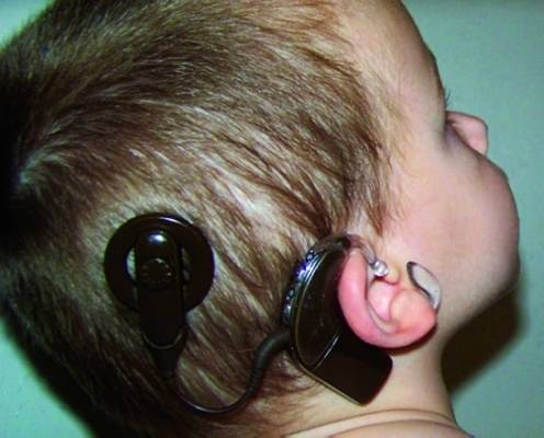 صرخة اهالي الاطفال زارعي القوقعة هل تصل الى رئيس الوزراء ؟!