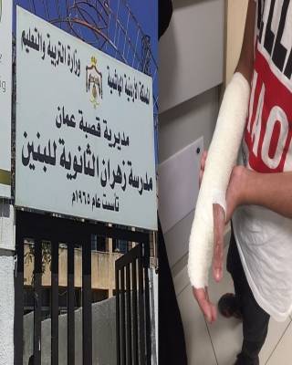 مطاردة معلم لطالب تؤدي الى كسر يد الطالب محمد الراميني .. (صور)