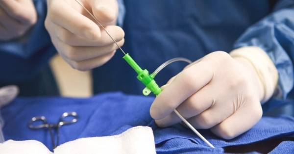 أخبار البلد تقوم بعملية قلب مفتوح لملف الشبكات القلبية