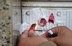 اغلاق احترازي لمحطة مياه بعد تسمم 17 شخصاً في جرش