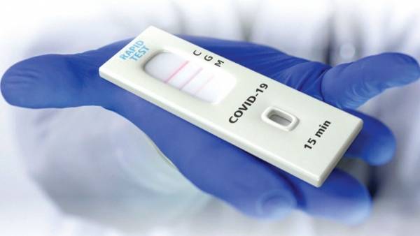 نقيب الصيادلة يدعو للسماح ببيع فحوصات كورونا السريعة