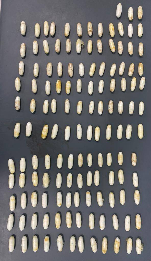 إحباط تهريب كوكايين داخل أحشاء أجنبيين