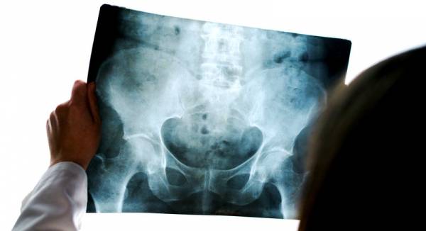 التصوير الشعاعي أثناء رمضان هل يبطل الصيام؟.. الافتاء تنهي الجدل