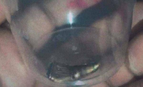 صورة الرصاصة التي اغتالت شرين ابو عاقلة