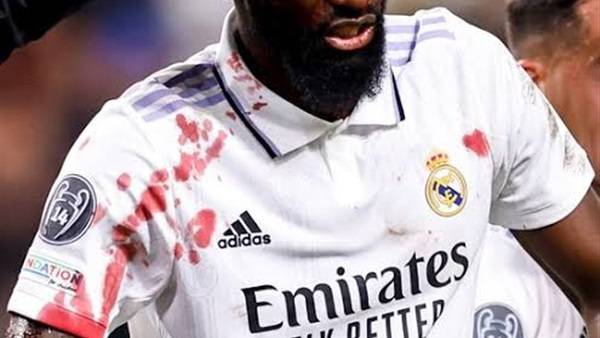 قميص روديجير المُلطخ بالدماء يُزين متحف ريال مدريد