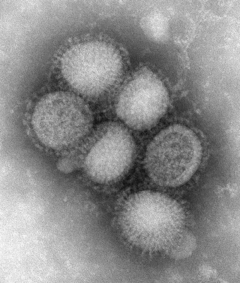 فيروسات الإنفلونزا تسود المملكة