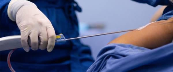 حصر عمليات شفط الدهون بأطباء التجميل