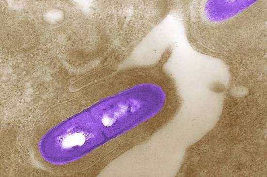 بعد تسببه بثلاث وفيات في أميركا.. ما هو داء الليستريات