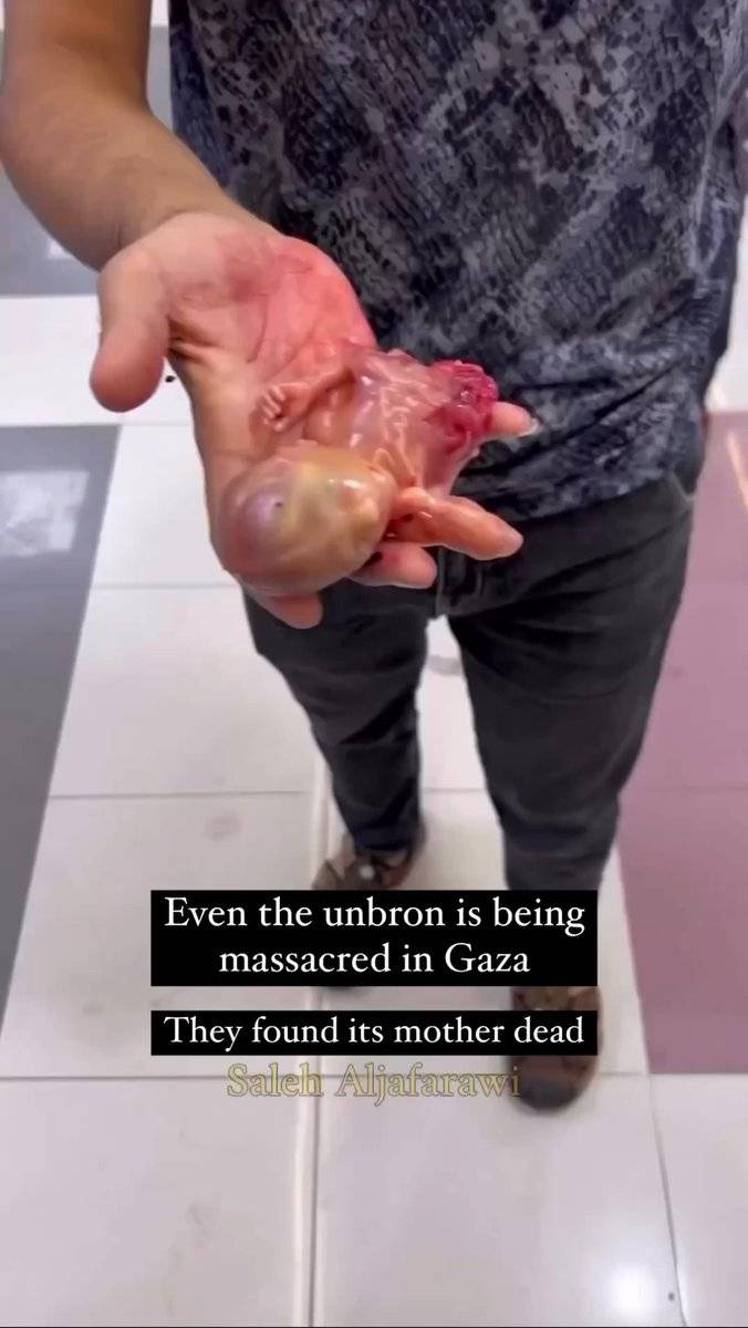 فيديو .. الاحتلال يغتال جنيناً فلسطينياً في بطن أمه