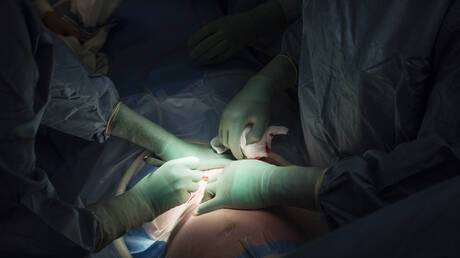 الحوامل في غزة يخضعن لعمليات قيصرية دون تخدير!