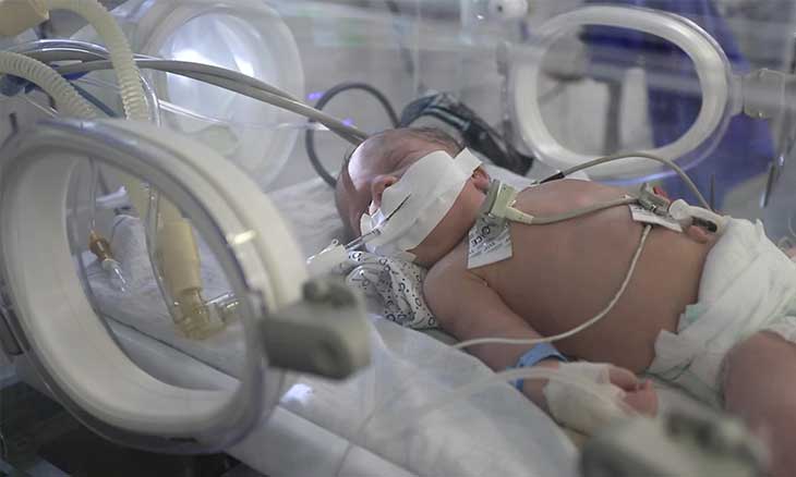 تحذير من وفاة الأطفال الخدج بسبب نقص الوقود