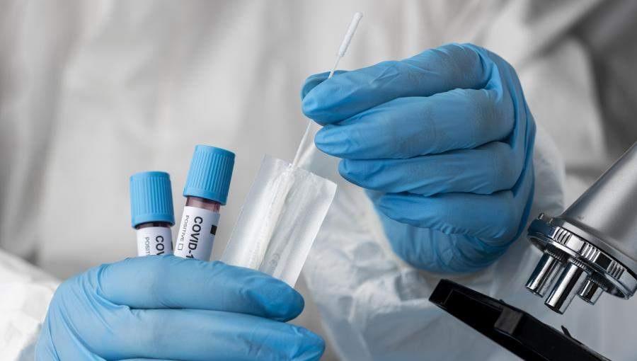 مليون إصابة بفيروس كوفيد عالميا خلال شهر