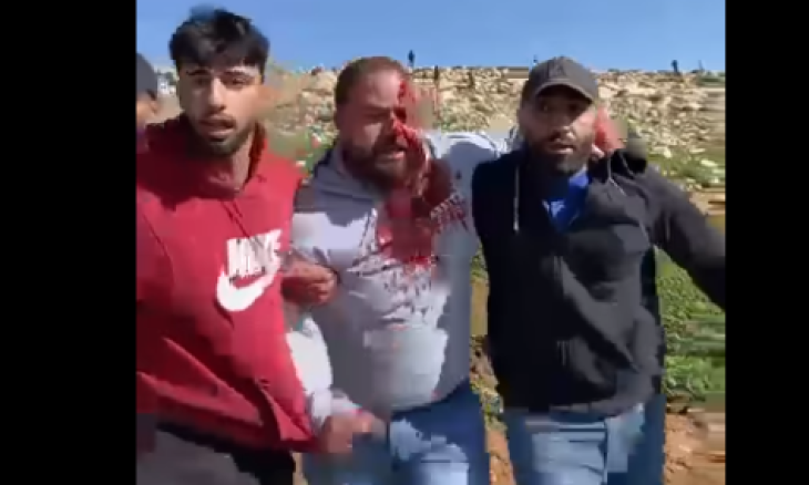 مستوطنون إسرائيليون يهاجمون تجمعات فلسطينية في الضفة الغربية (صور وفيديو)