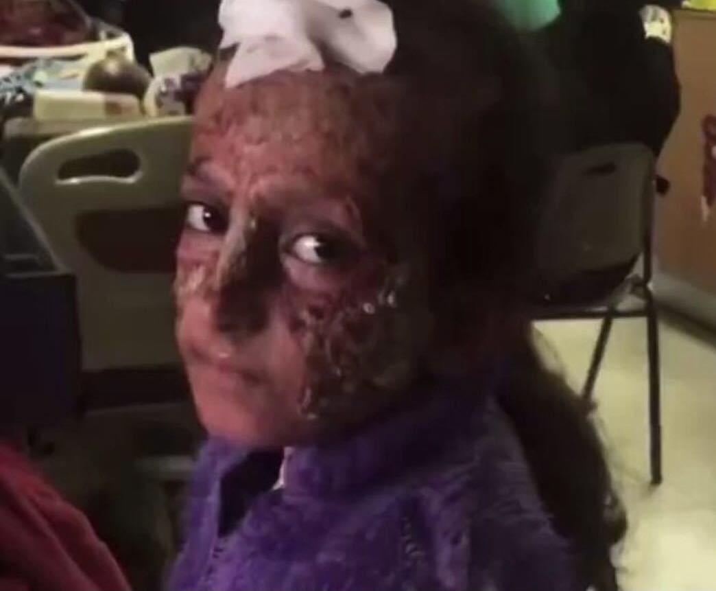 من يورد للصهاينة الفسفور الابيض الذي شوه وجوه اطفال غزة