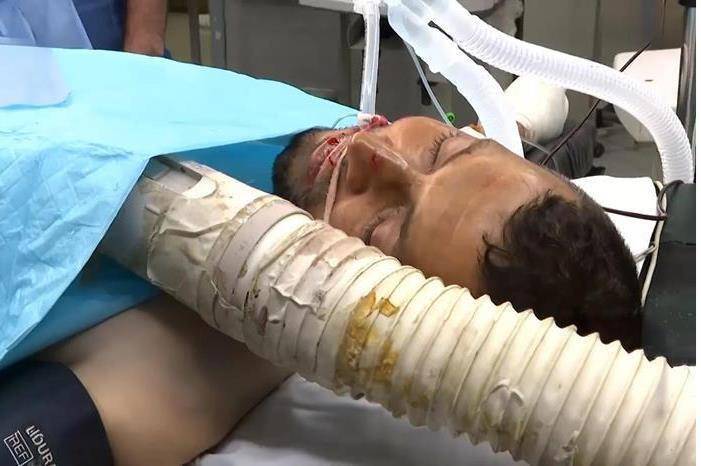 تدهور الوضع الصحفي لمراسل الجزيرة إسماعيل أبو عمر