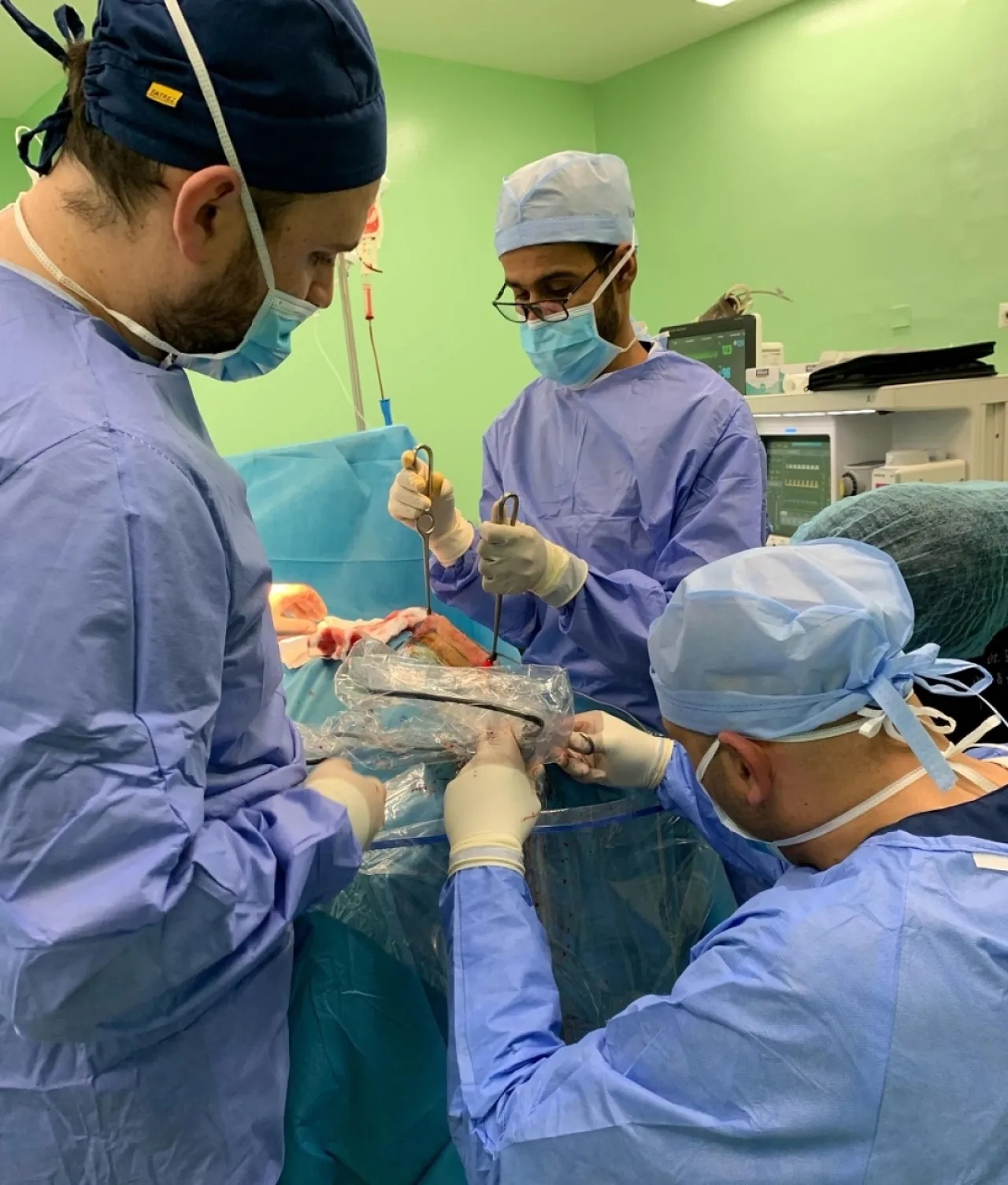 لأول مرة بالأردن.. نجاح عملية لجراحة المنظار بتصحيح تشوهات جمجمة الأطفال