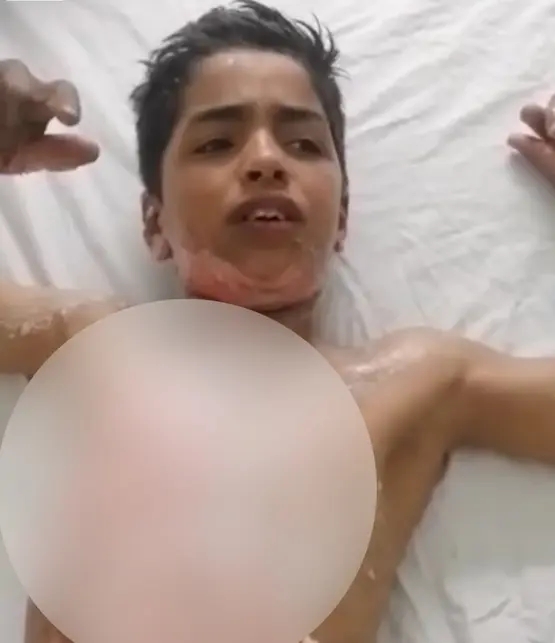 معلومات جديدة عن حادثة حرق طالب في مدرسة بالرصيفة.. تفاصيل