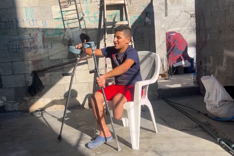 الأمم المتحدة: في غزة أكبر عدد للأطفال مبتوري الأطراف بالتاريخ الحديث