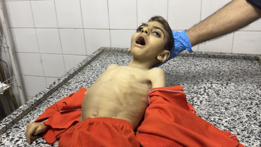 صورة مؤلمة... استشهاد طفل جوعا في غزة