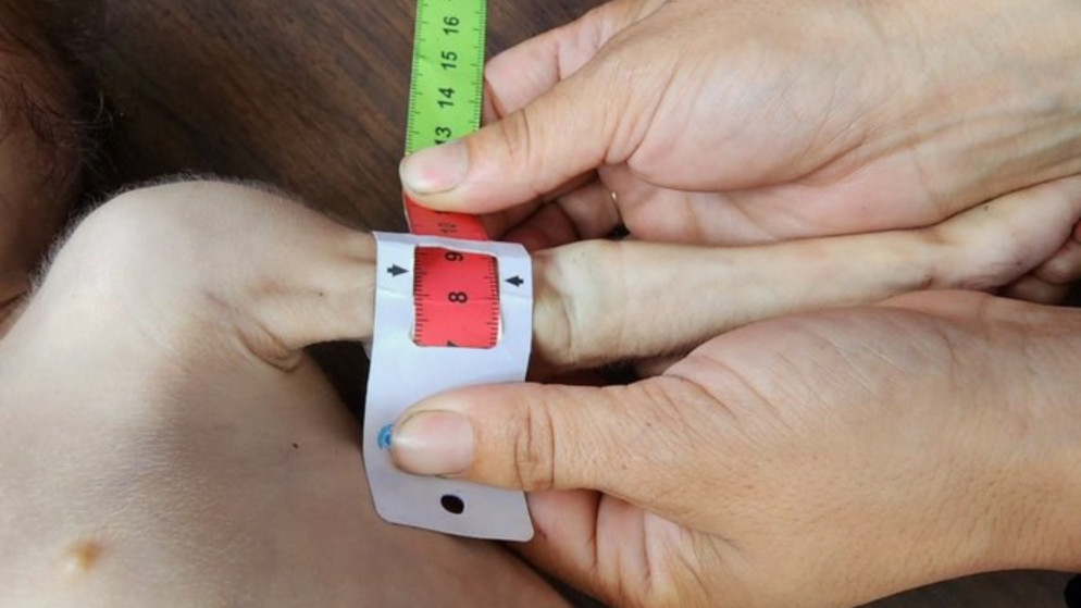 أونروا تفيد بتلقي رسائل استغاثة من موظفيها في غزة جراء الجوع