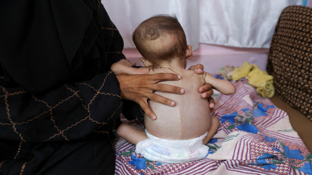 منظمة الصحة: ارتفاع قاتل في سوء التغذية بغزة