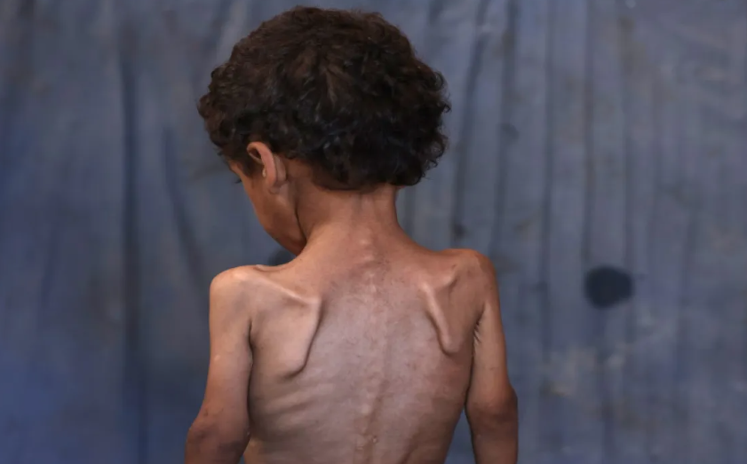 البرازيل ستنضم لقضية إبادة جماعية رفعتها جنوب إفريقيا على إسرائيل