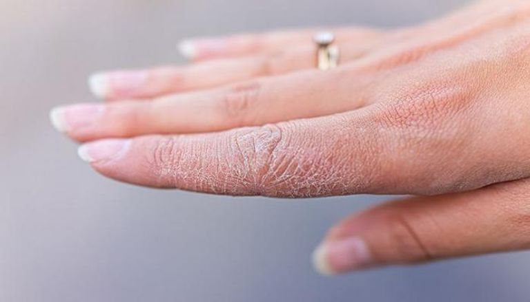 نقص الزنك.. أعراض تحذيرية وأهمية لا يمكن تجاهلها